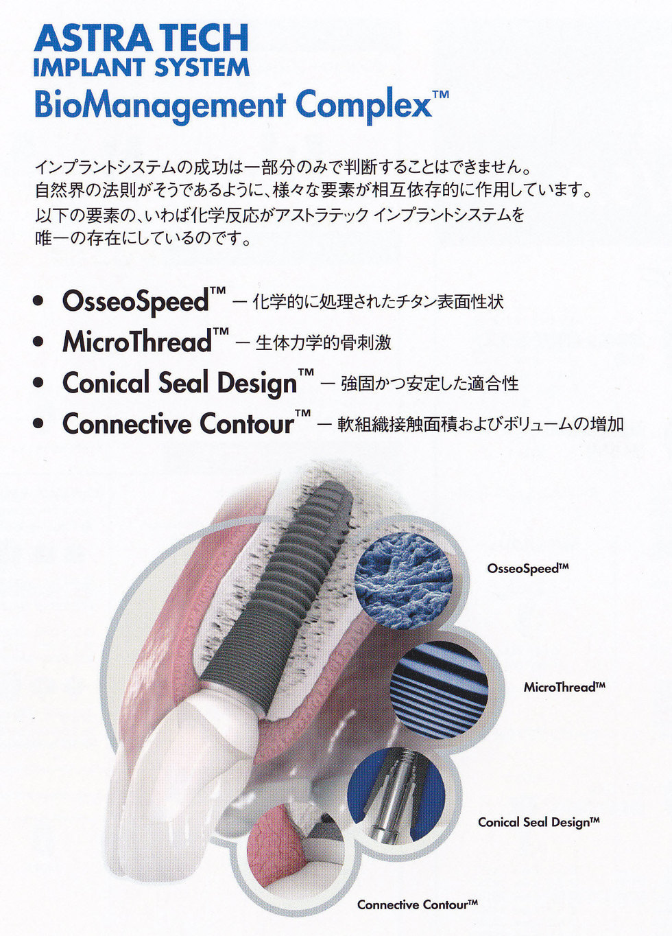 アストラテックインプラントシステムの好きなところ