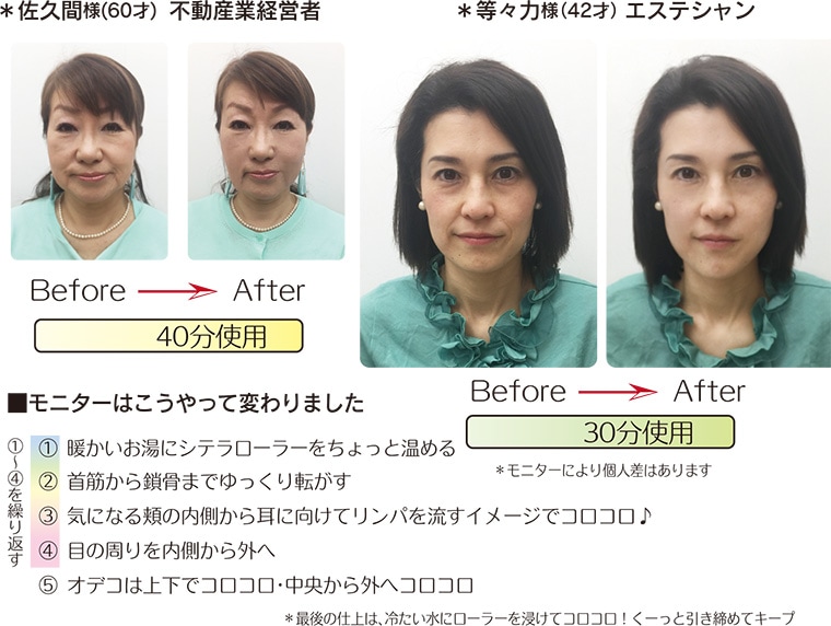 ケイ素鉱石でできた美顔ローラー『SITERA403』 / 渋谷トレンド公式