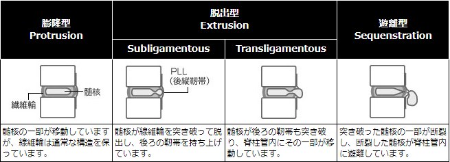 椎間板ヘルニア - はちや整形外科病院