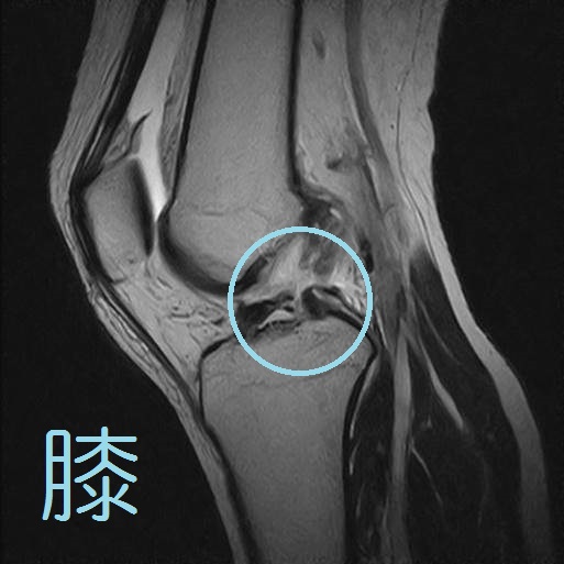 MRIについて | 東広島整形外科クリニック