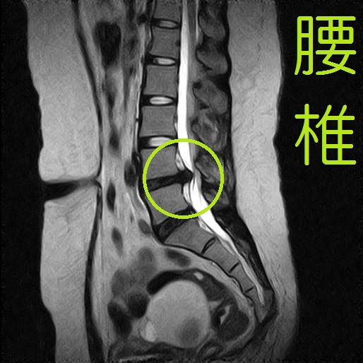 MRIについて | 東広島整形外科クリニック