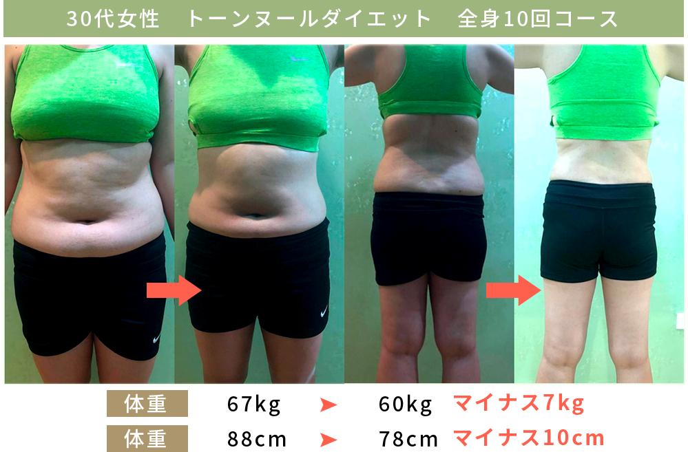 トーンヌールダイエット | 【公式】Re:age │ 肌で飲む漢方「トーン