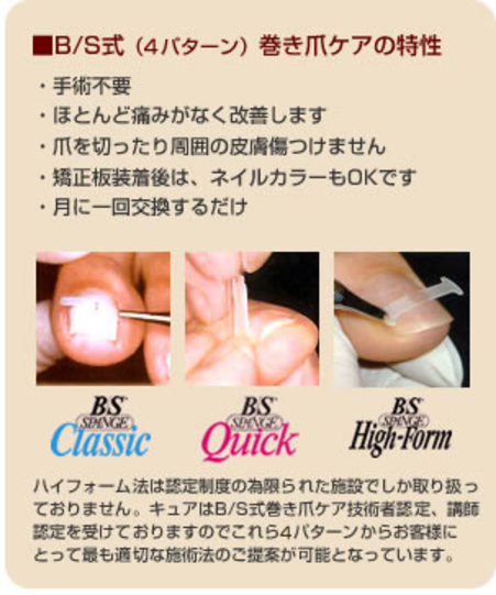 ドイツB/S SPANGE（スパンゲ）法 | たかはし施術院