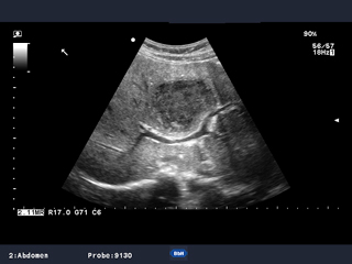 プロサウンドα7（超音波 - 据え置き/汎用）- 株式会社日立製作所