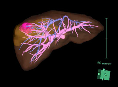 肝胆膵グループ - 横浜市立大学医学部 消化器・腫瘍外科学【公式】