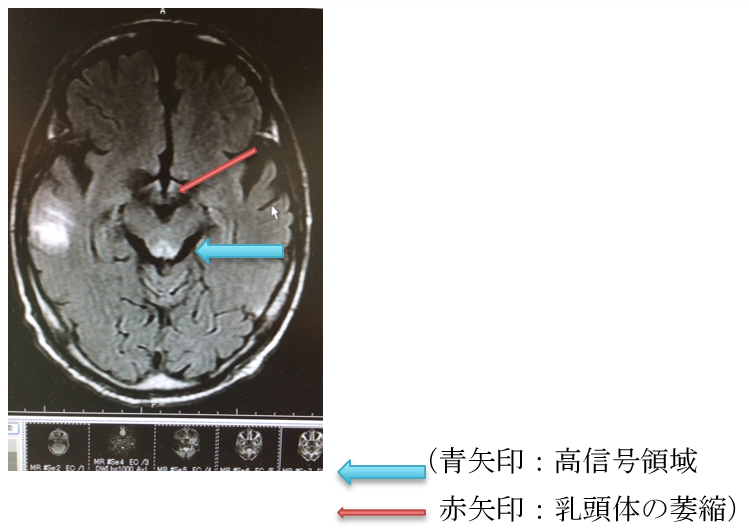EMA症例50: 6月症例解説 | EM Alliance