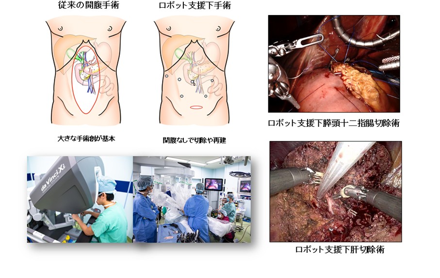 肝・胆・膵外科｜臨床｜岡山大学大学院医歯薬学総合研究科 消化器外科学