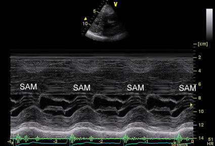 エコー動画集 | 愛媛大学医学部 循環器・呼吸器・腎高血圧内科学（第二