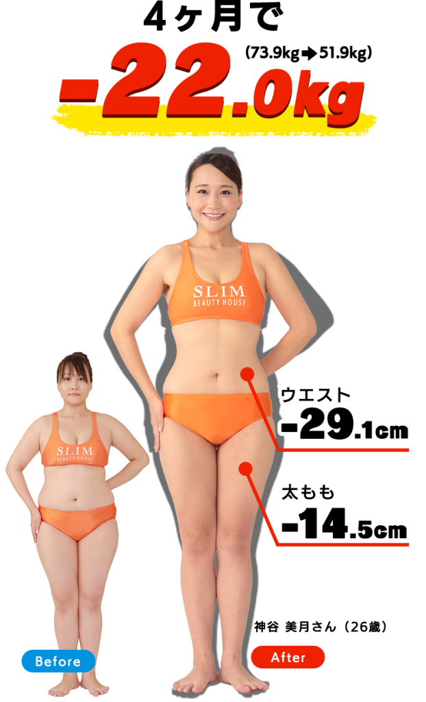 セルライト除去エステ安いおすすめ11選・初回体験のみでも効果はある