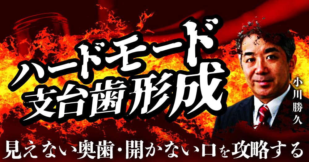 ハードモード支台歯形成。見えない奥歯・開かない口を攻略する｜歯科