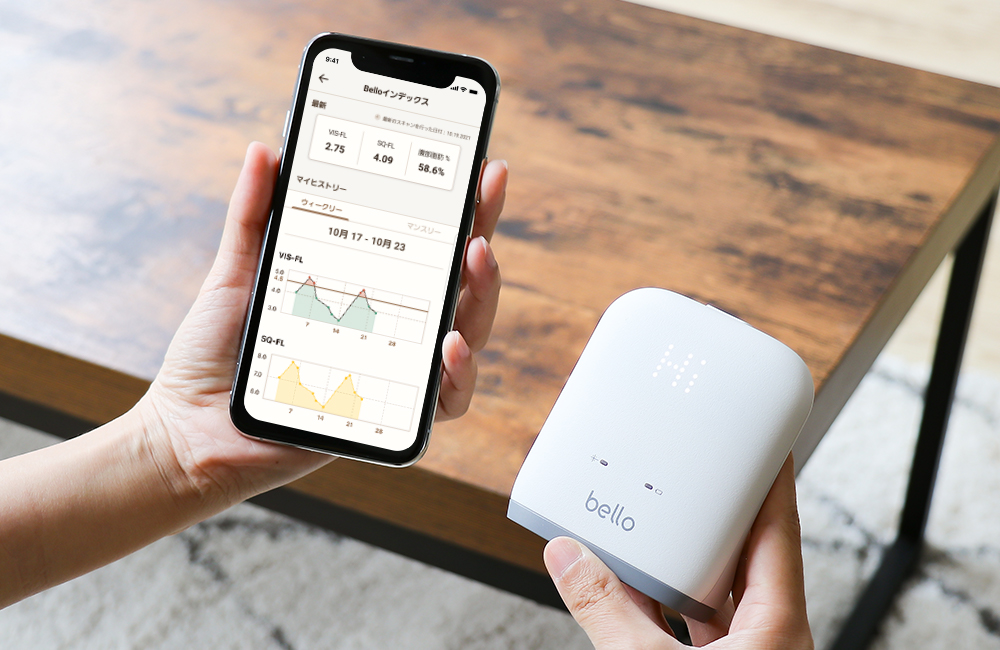 BELLO 体脂肪スキャナー ベロ 3R-BEL01 | スリーアールソリューション