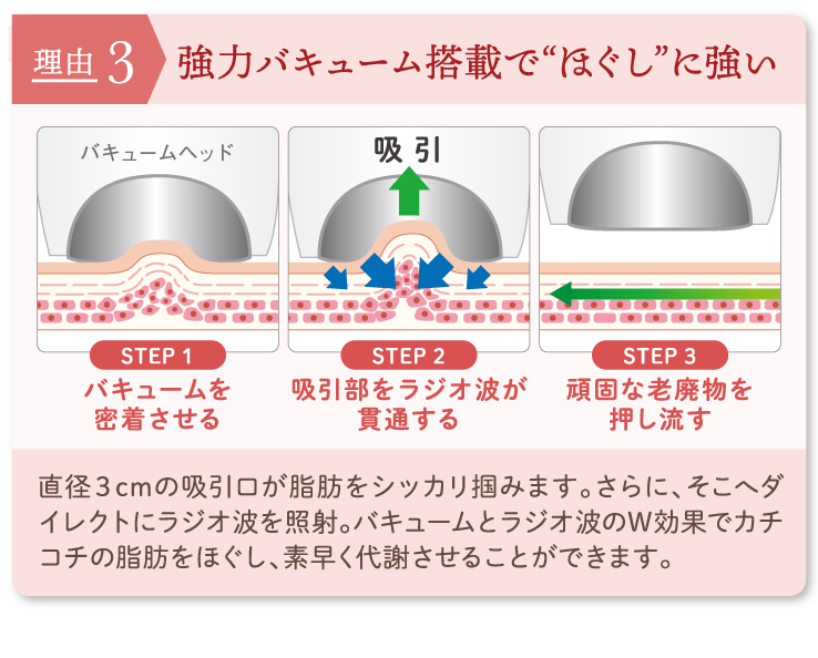 業務用キャビテーション Cavistar 2000 | キャビテーション機器専門店
