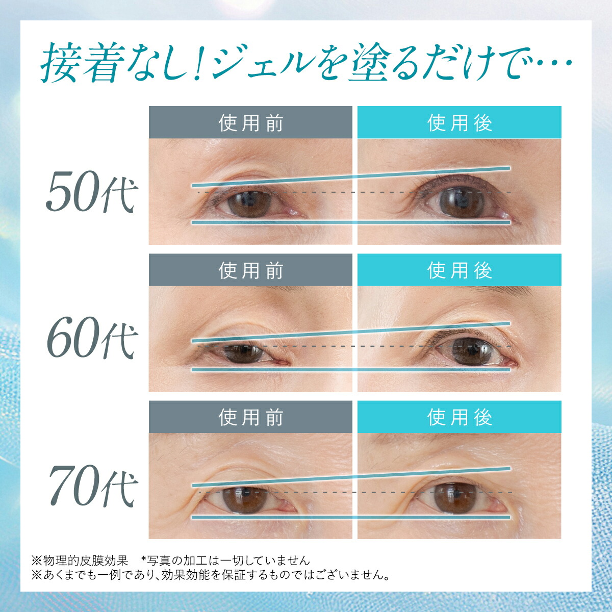 楽天市場】まぶた 引き上げ ジェル 整形膜「リッドキララ」北の快適