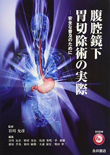 楽天市場】令和スタイル鏡視下胃手術のすべての通販