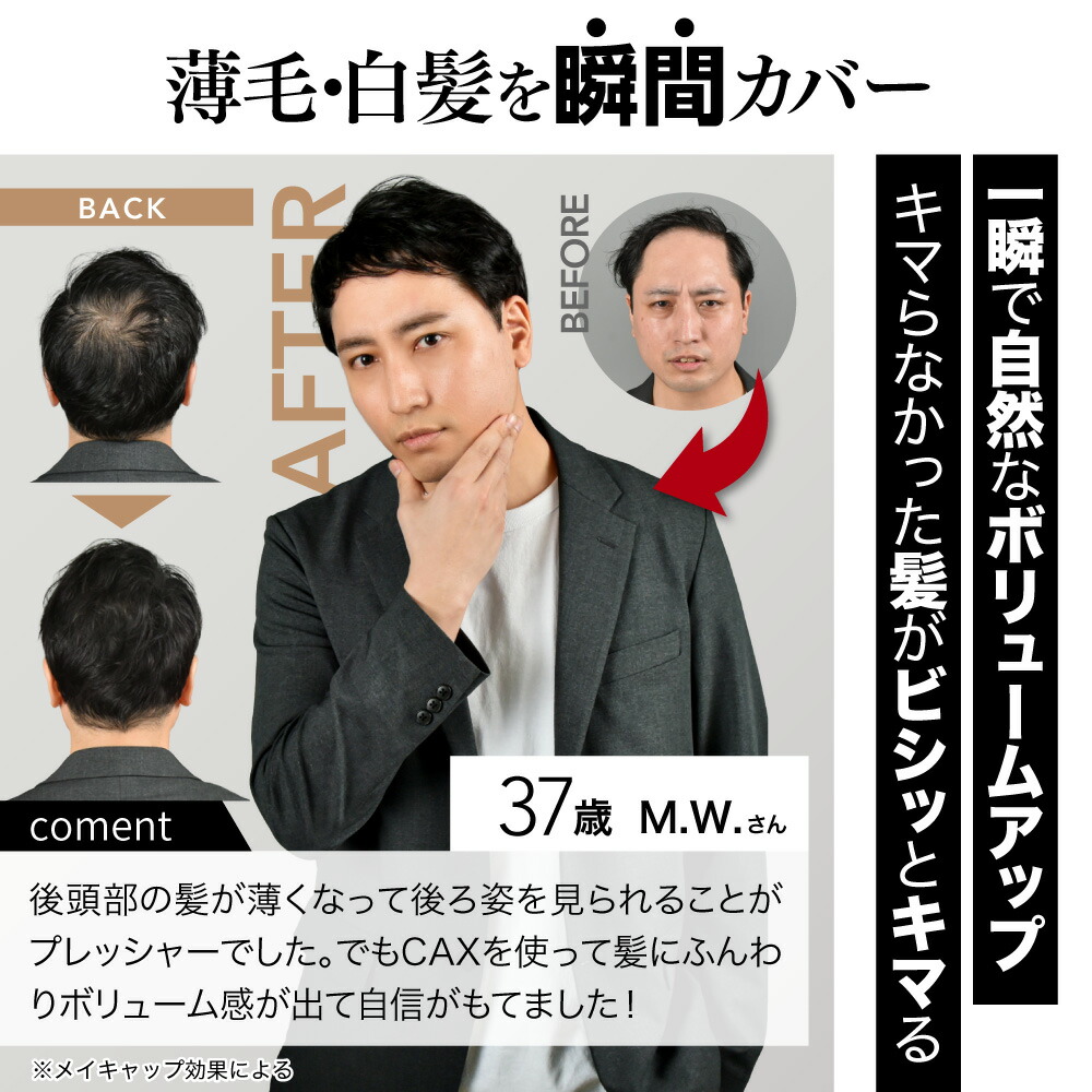 楽天市場】4本+1本おまけ CAX ボリュームアップヘアスプレー 薄毛隠し