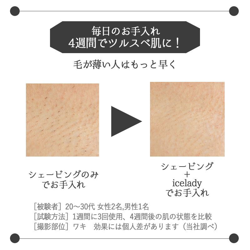 楽天市場】Notime icelady アイスレディ 全身脱毛器 家庭用光美容器