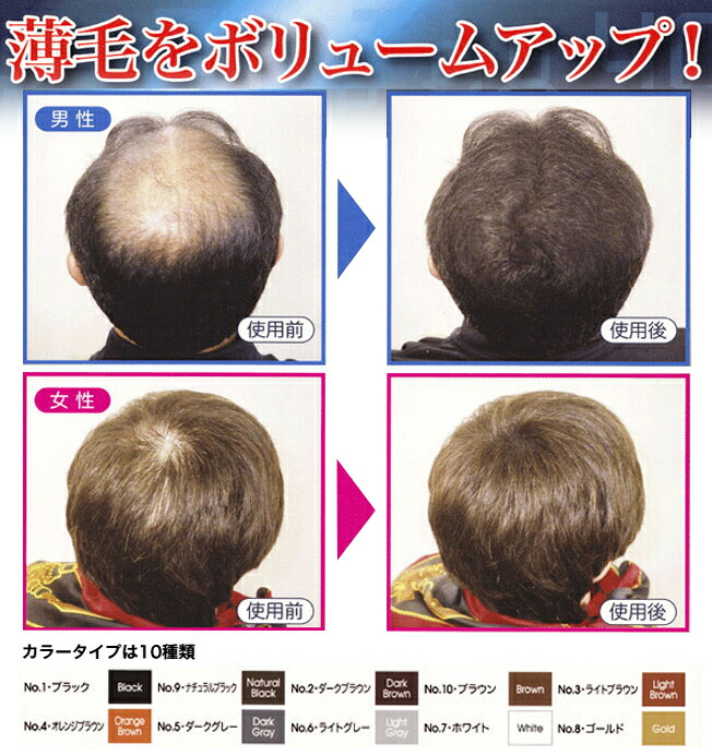 楽天市場】ティップトップ40 40g ボリュームアップ 薄毛 パウダー 薄毛