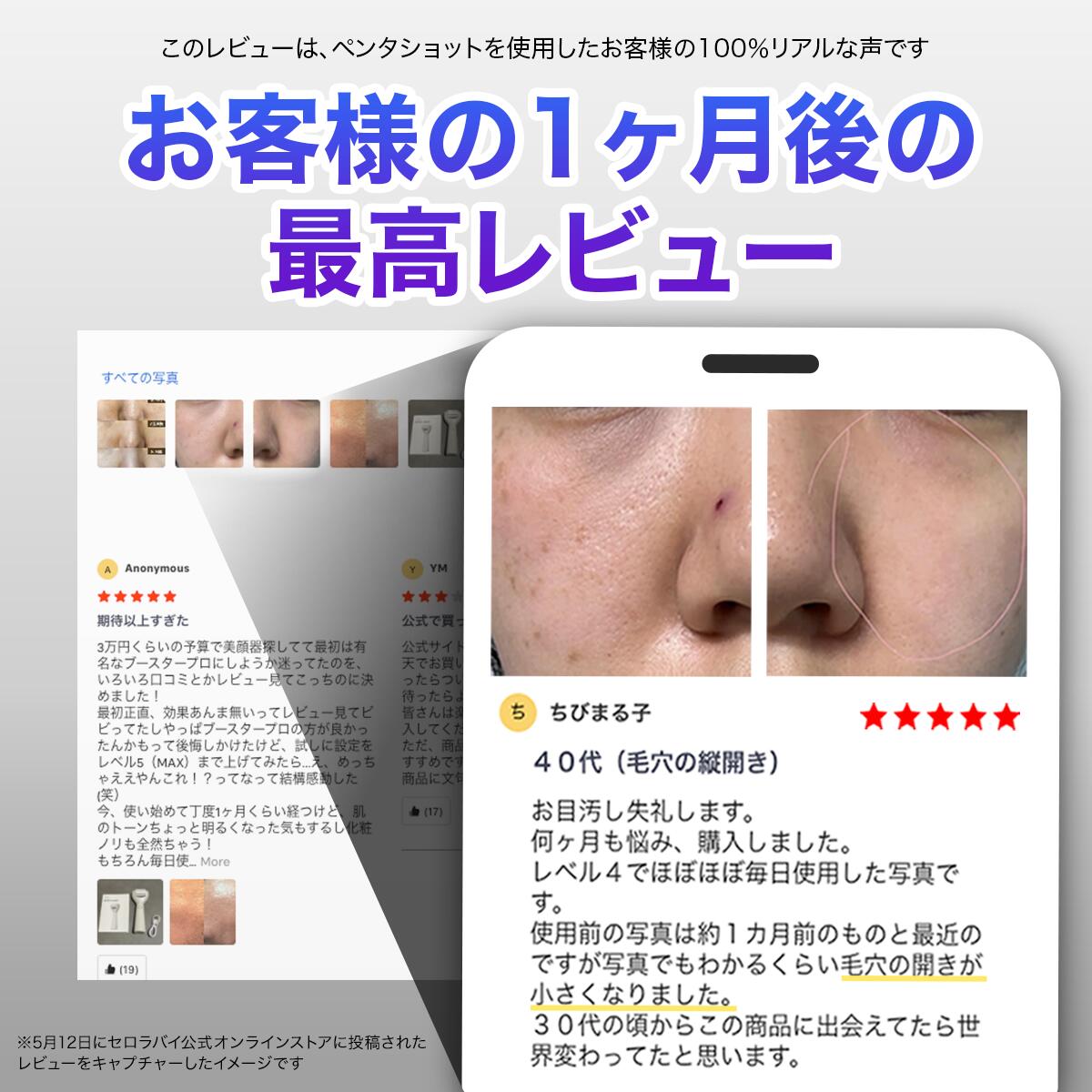 セロラバイ ポテンション ペンタショット 楽天市場】【セロラバイ公式