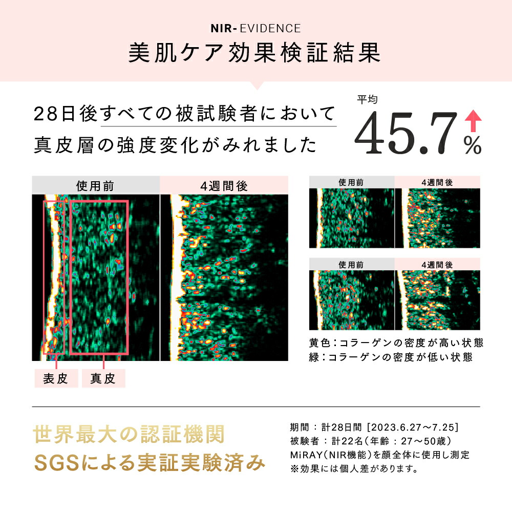 楽天市場】MYTREX MiRAY 専用 NIR リフトアタッチメント 【MYTREX公式