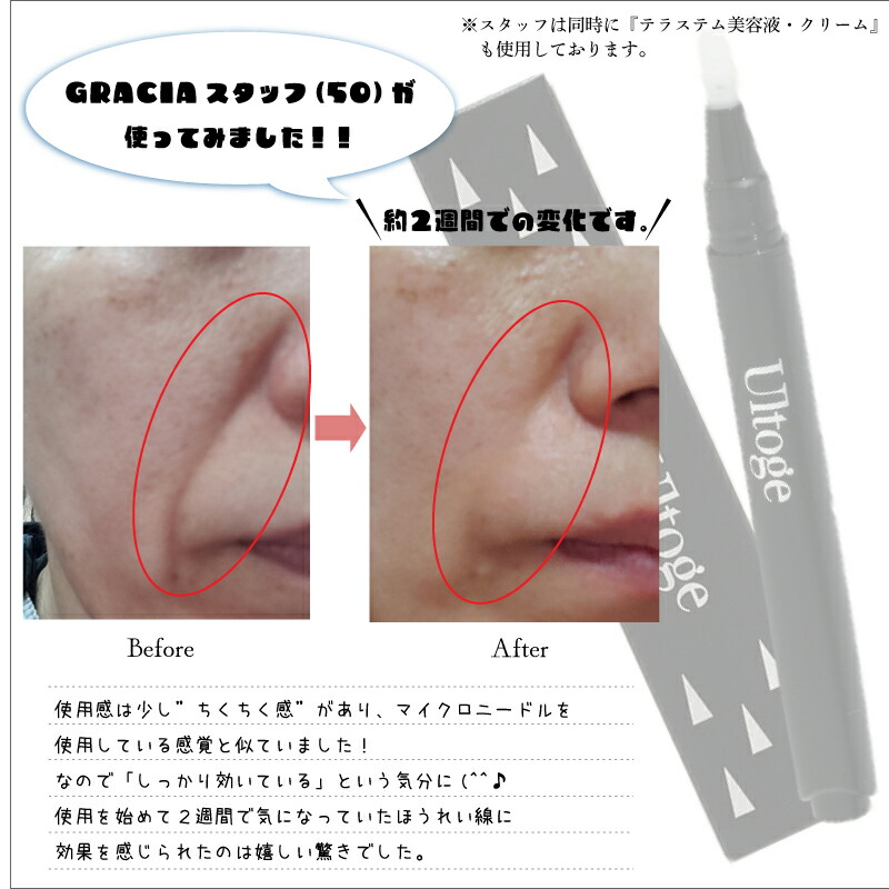 楽天市場】ウルトゲ 『塗る』針美容液！ヒアルロン酸100％の結晶