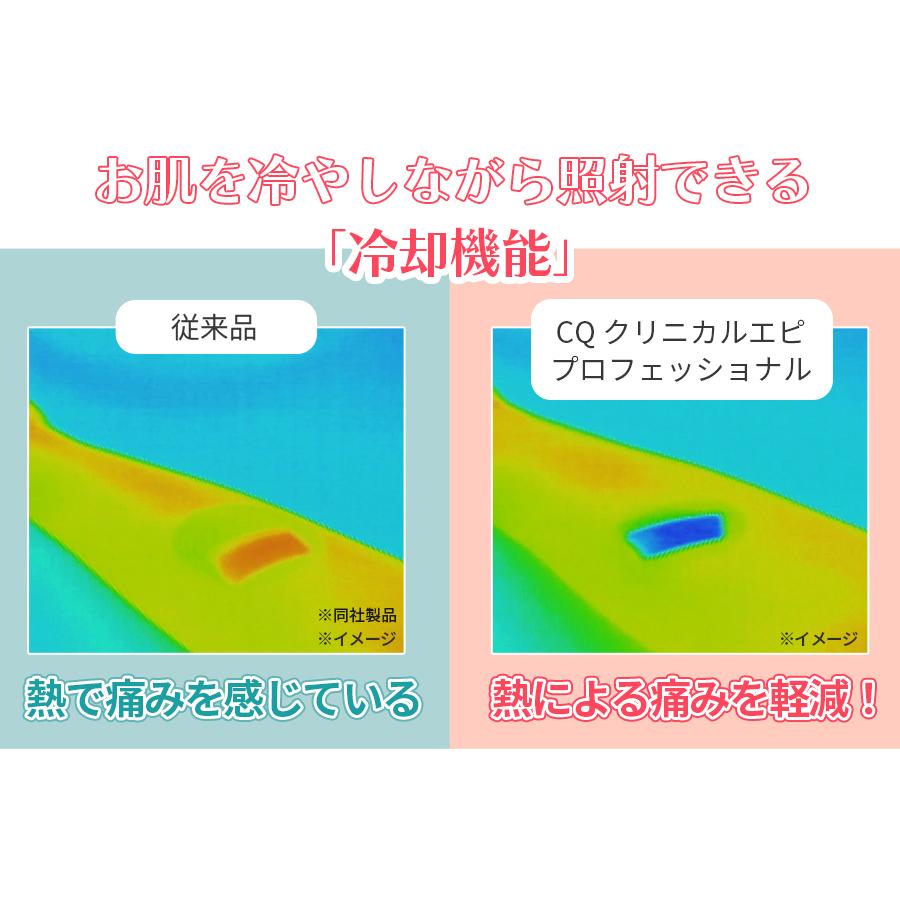 楽天市場】CQ クリニカルエピプロフェッショナル ／ ムダ毛