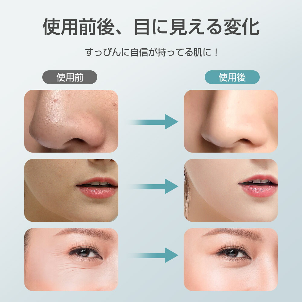 楽天市場】＼限定クーポンで2,779円！／楽天1位 美顔器 超音波美顔器