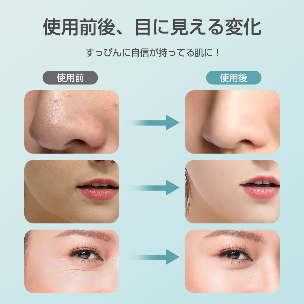 楽天市場】楽天1位 温冷美顔器 超音波美顔器 1台13役多機能美顔器