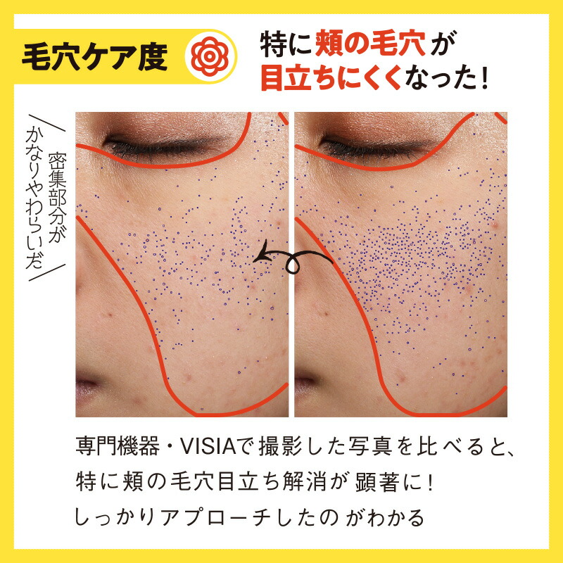 楽天市場】毛穴 ビタミンC 美容液【LDK 1位】CELASEEQ／セラシーク