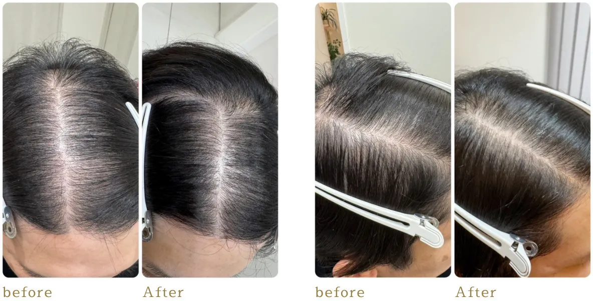 プロセルセラピーズ（薄毛・育毛／フェイシャル） | KOCHOURAN