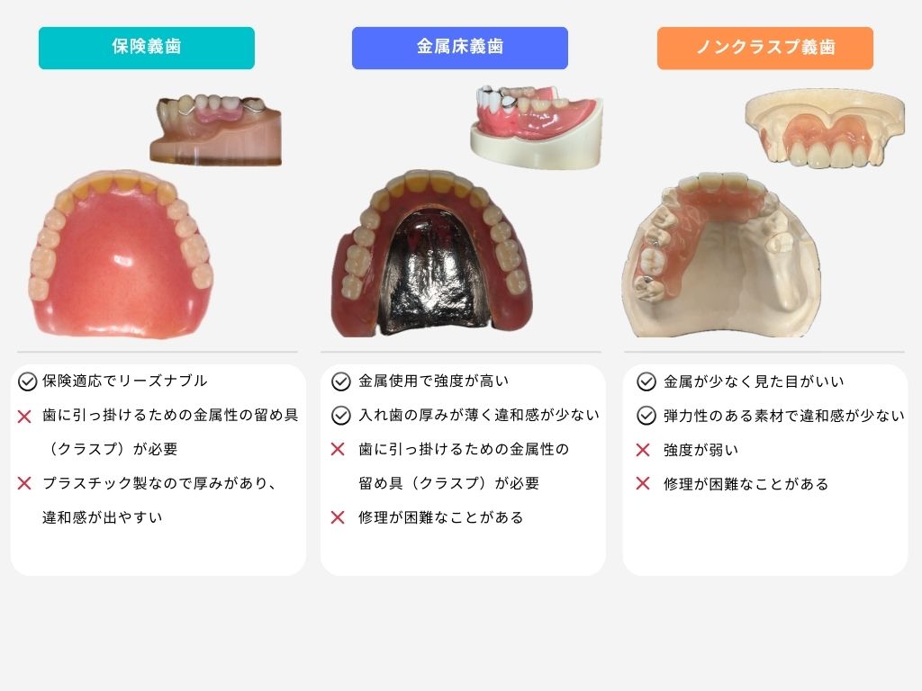 入れ歯（総義歯・部分義歯）｜検見川浜の歯医者｜上野歯科医院