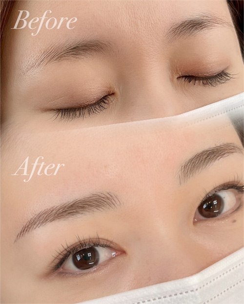 医療用アートメイク｜ユリシスクリニック 浜松市