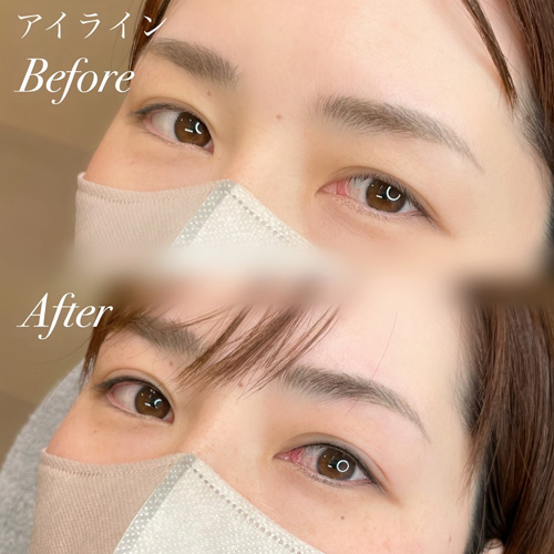 医療用アートメイク｜ユリシスクリニック 浜松市