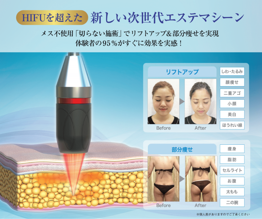 マシン一覧 – 小顔UNA学芸大学店