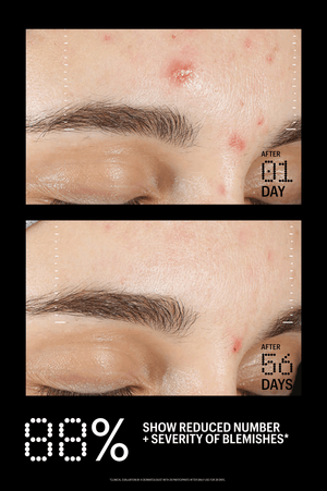 Azelaic & Kojic Advanced Clarifying Serum – ALLIES [North America]