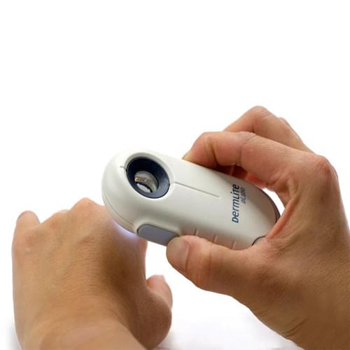 DermLite DL100 Dermatology Dermascope | DermLite Dermascopes