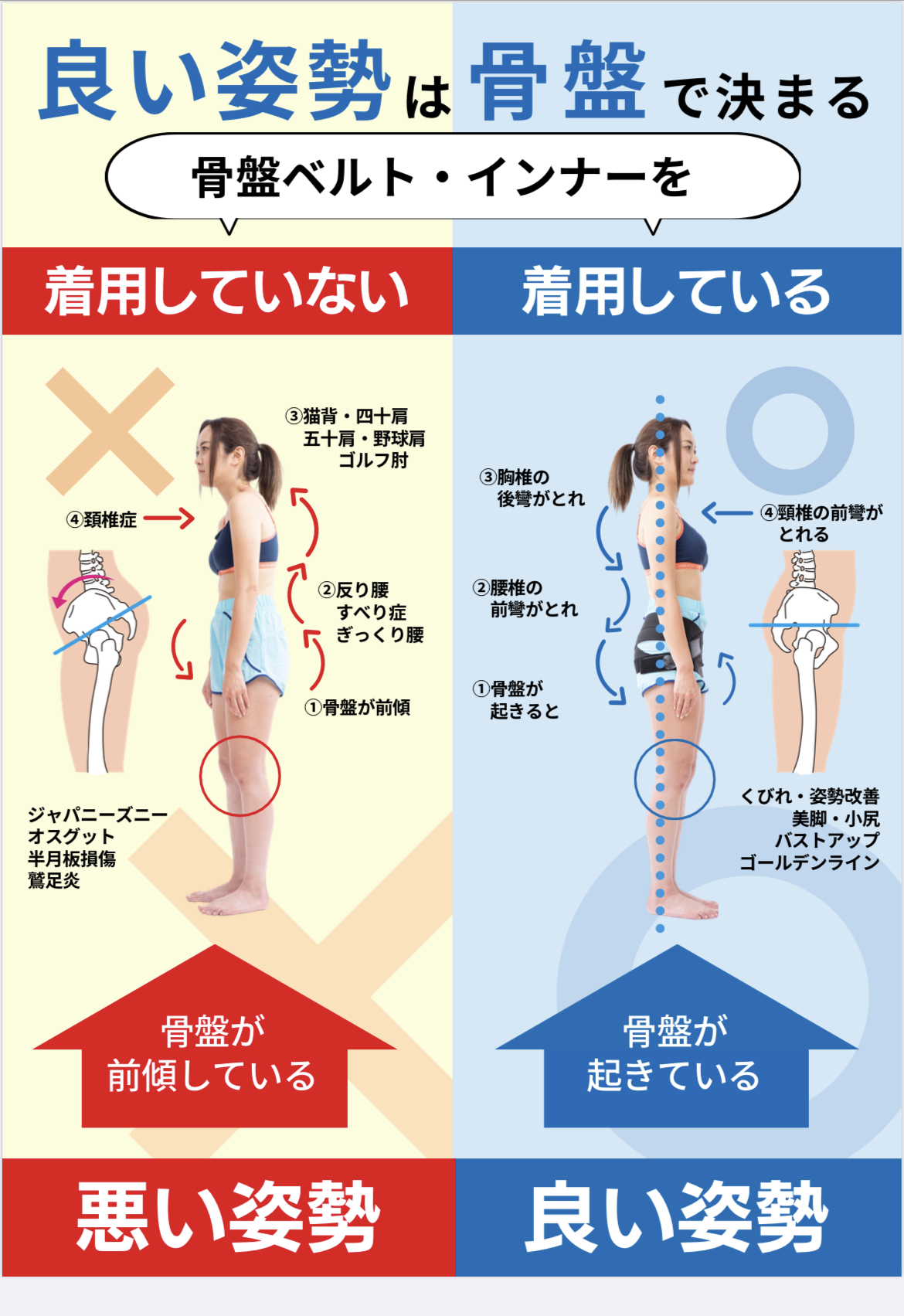 骨盤サポートインナー 【ヨーキヒ】 | 三徳接骨院三徳接骨院