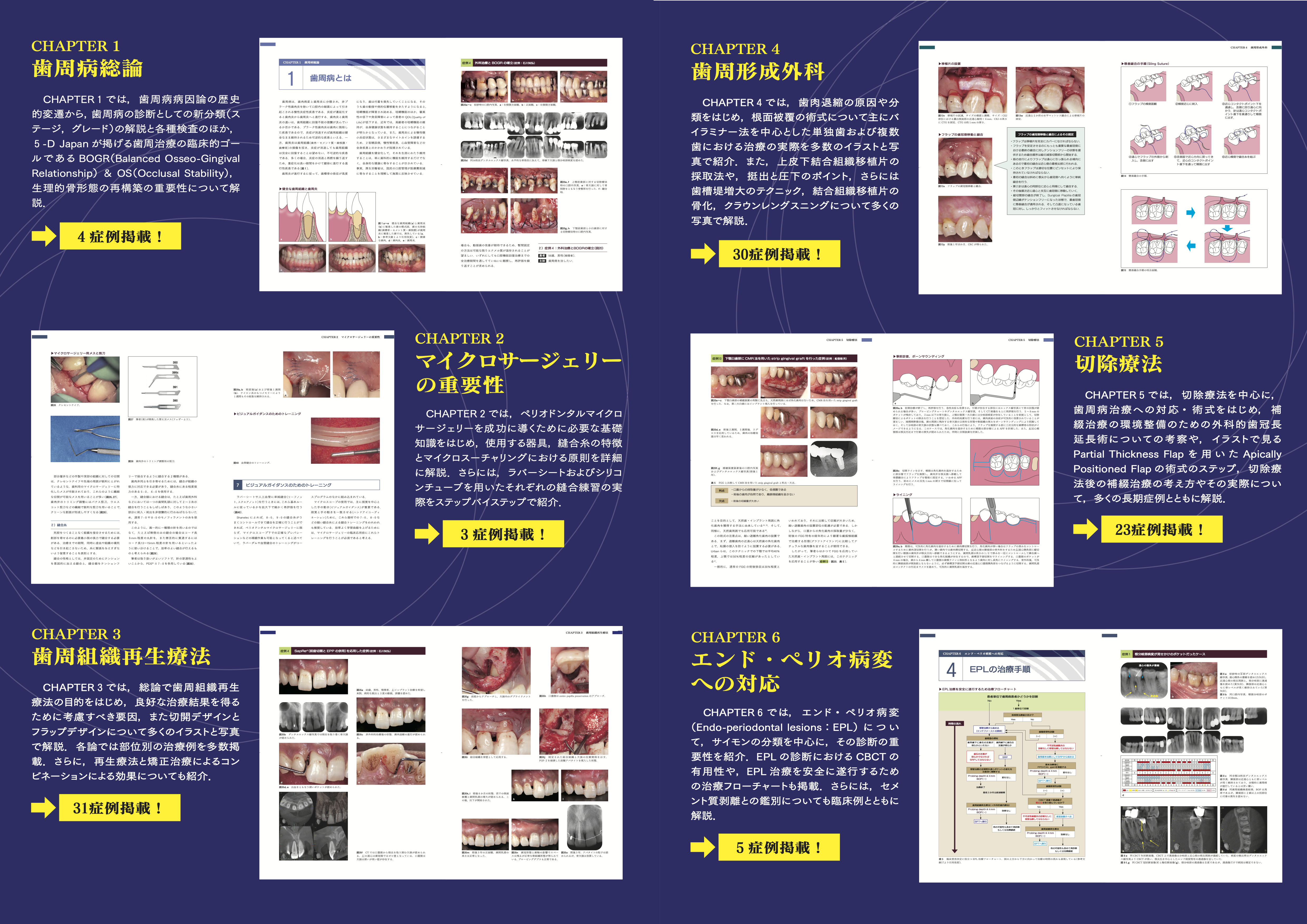 4/10(木) 5-Dコンセンサス 歯の保存にこだわるが発売されました！ | 5
