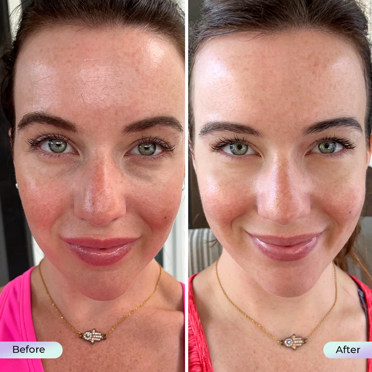 Aduro LED Facial Mask