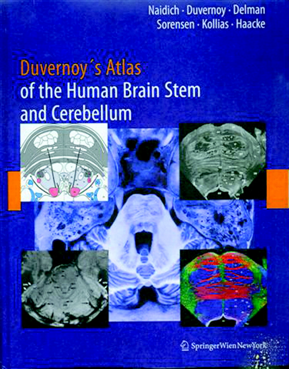 Duvernoy's Atlas of the Human Brain Stem and Cerebellum | American