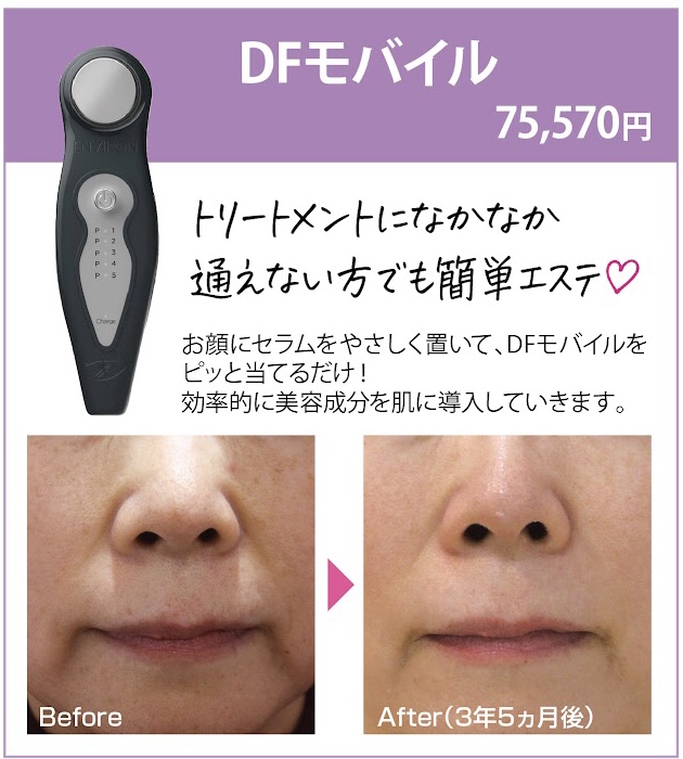 エンビロンの効果を底上げする美顔器 | ascイオンモール徳島店