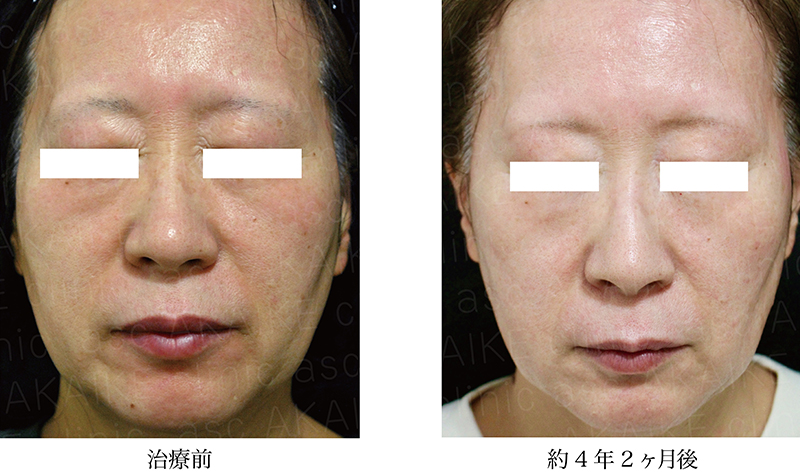 エンビロン ロールキット | 徳島の美容クリニック 赤池クリニック