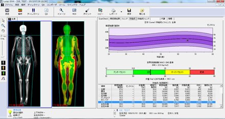 日常診療に役立つサルコペニアに関する基礎知識 | GE HealthCare (Japan)