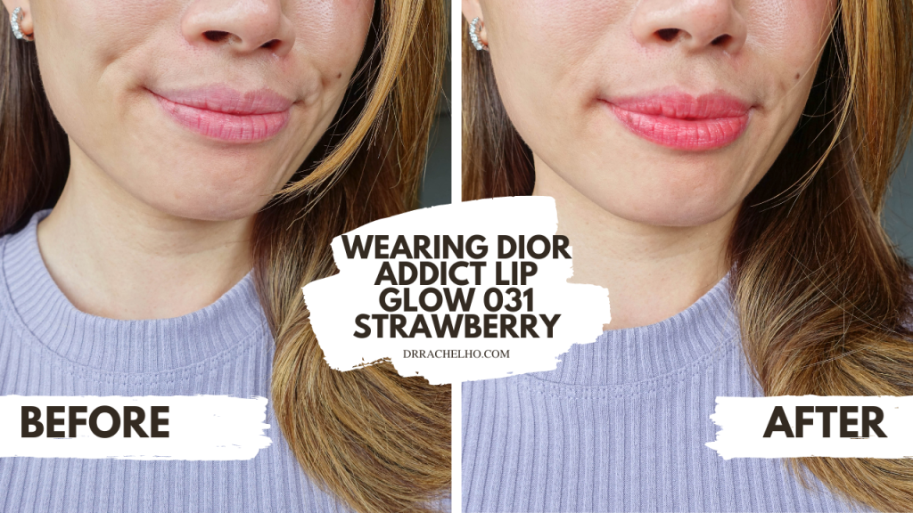 Review: Dior Addict Lip Glow 031 Strawberry - Dr Rachel Ho