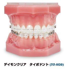 コンサルテーション タイポドント | エンビスタジャパン株式会社 / EH