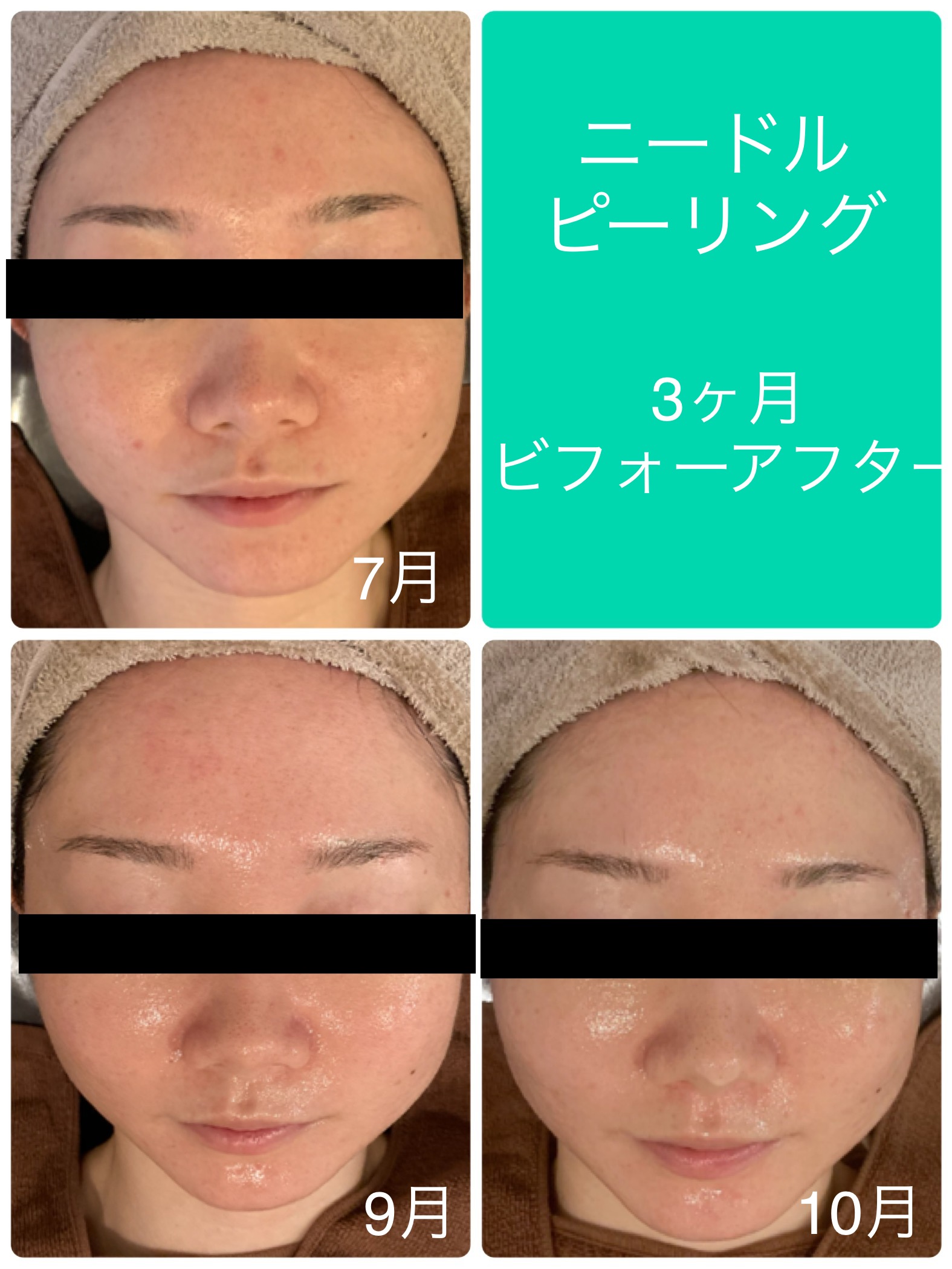 EF456ED0-2122-407E-86BC-