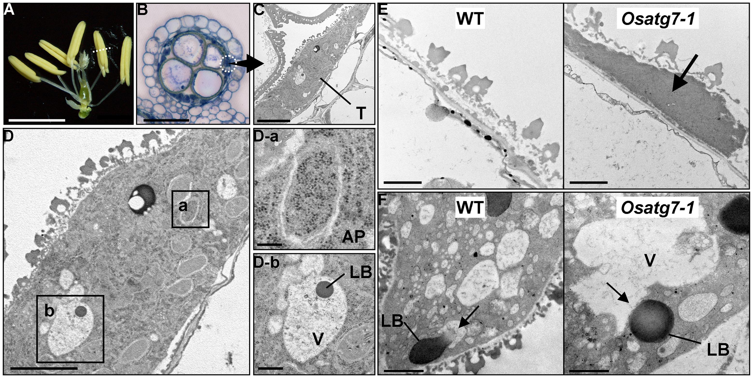 Frontiers | Roles of autophagy in male reproductive development in
