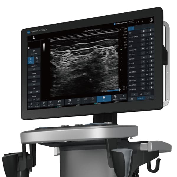 超音波診断装置 SONIMAGE UX1 | コニカミノルタ