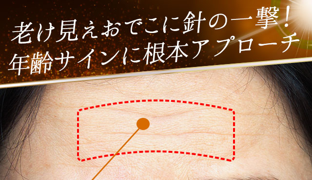 北の快適工房｜『オデコディープパッチ』