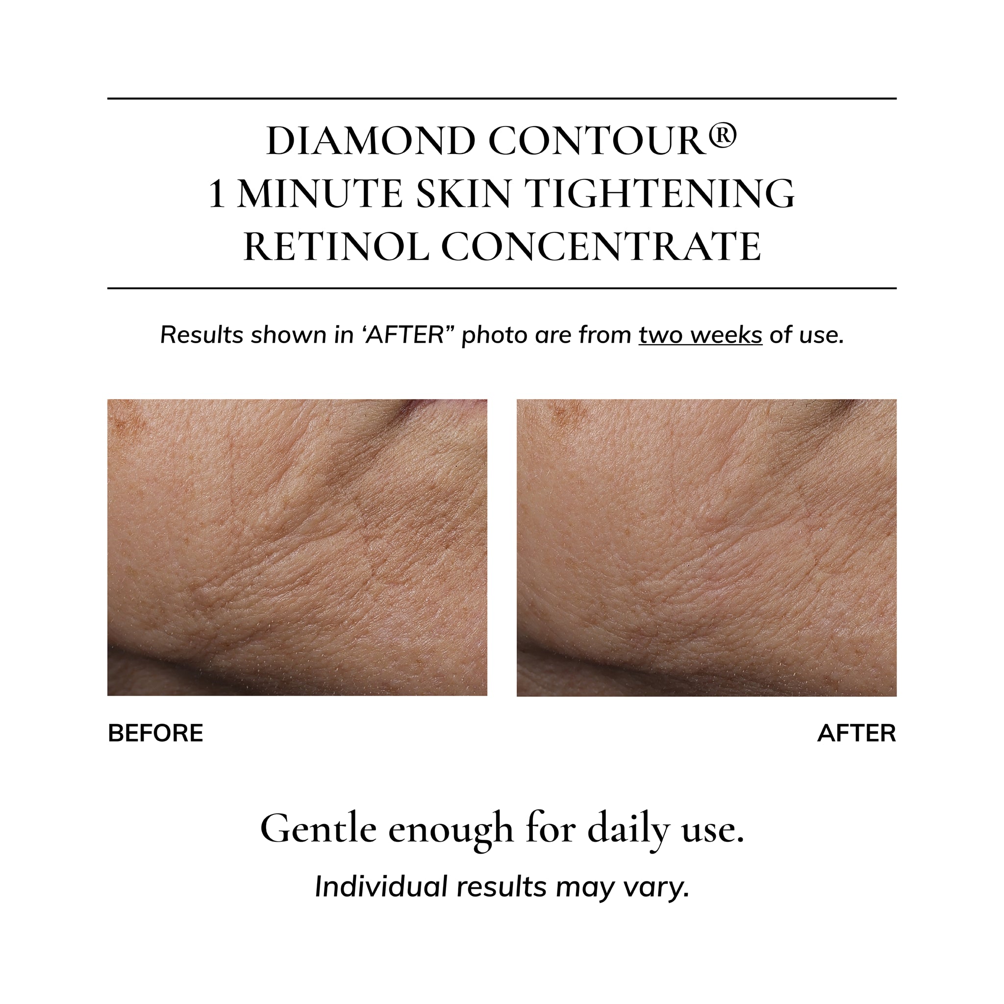 Diamond Contour® 1 Minute Skin Tightening Retinol Concentrate