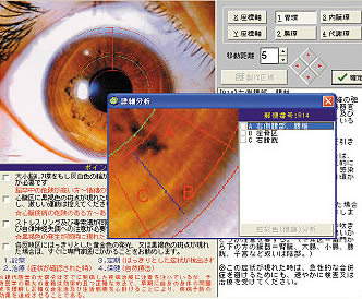 虹彩について - デッドシースパ日本初の老舗サロン - kibbnet(キブネット)